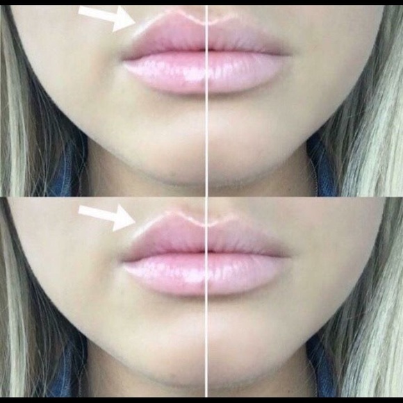 2 Lip Plumping Balms - Picture 2 of 10